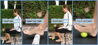 More Planters Fasciitis Exercise Treatments